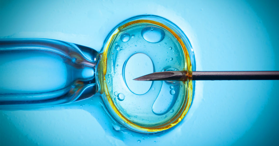 In Vitro Fertilization (IVF)